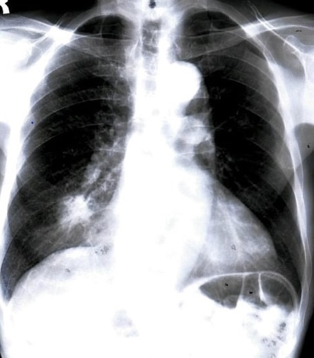 IT’S JUST A&nbsp;FLUKE